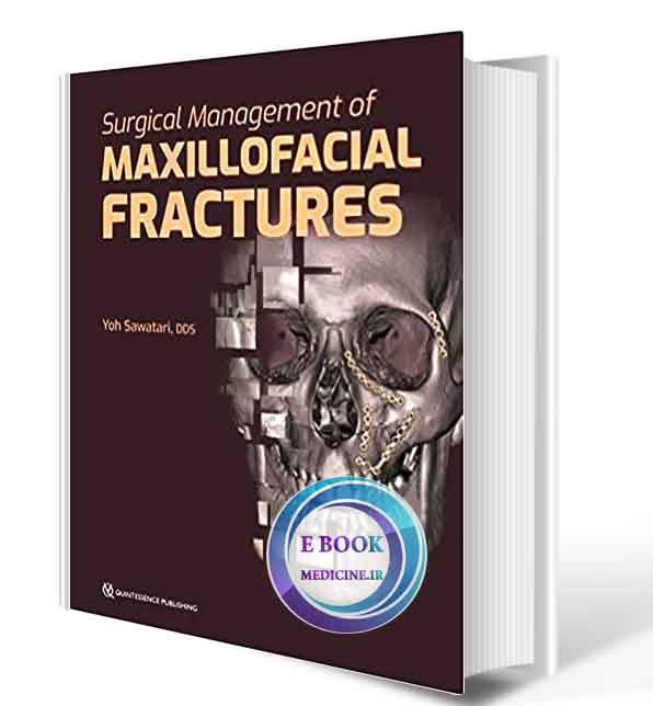 دانلود کتاب Surgical Management of Maxillofacial Fractures 1st  2019 ( PDF)